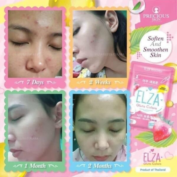 PRECIOUS SKIN ELZA D.T.X 60Grm